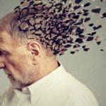 alzheimer FocusFillWzczNiw0MTQsIngiLDQ2XQ