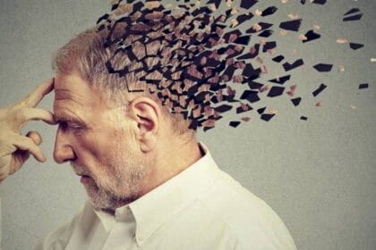 alzheimer FocusFillWzczNiw0MTQsIngiLDQ2XQ