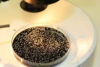 legionella