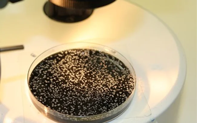 legionella