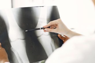 saude cavado radiografica ULSBE