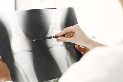 saude cavado radiografica ULSBE