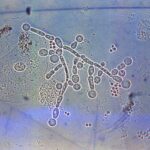 intestinos fungo flora uminh braga