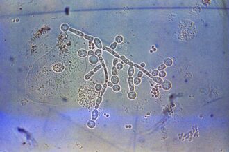 intestinos fungo flora uminh braga