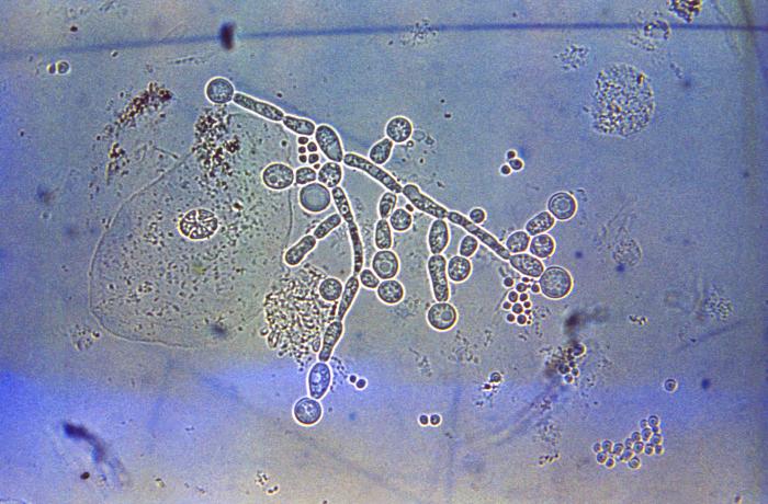 Braga: Estudo da UMinho identifica genes que podem travar infeções intestinais intestinos fungo flora uminh braga