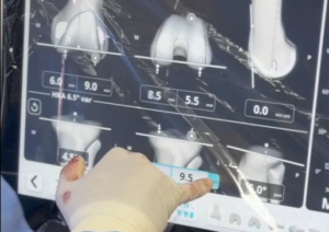Viana: Hospital de Santa Luzia estreia cirurgias robóticas ao joelho com sistema VELYS Captura de ecra 2026 07 09 182143