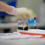 Póvoa de Varzim Associação de Dadores promove recolha de sangue esta quinta-feira