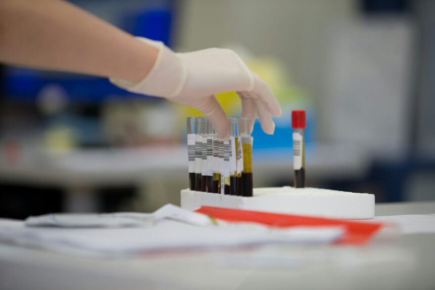 Póvoa de Varzim Associação de Dadores promove recolha de sangue esta quinta-feira